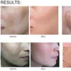 MCCM Melano Out Creme: Depigmentierende Behandlung zur Reduzierung von Pigmentflecken und Hyperpigmentierung | 30 ml - 2