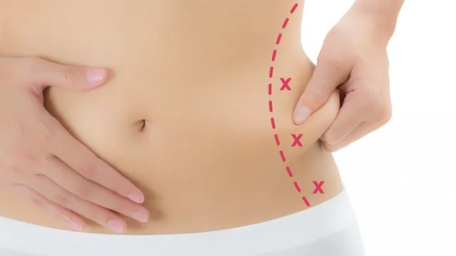 Destrói rapidamente a gordura localizada sem cirurgia - Métodos e conselhos