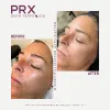 WIQO PRX PLUS | 5 Botellas de 4ml - 2