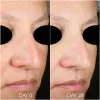 TEOXANE RHA HYDRA MASK Ultra-feuchtigkeitsspendende und aufpolsternde Maske | 50ml Tube - 2