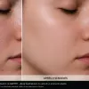GLEYSY Acne Control: Professional Complex for Blemish-Prone Skin | 5 bottles, 10 ml each - 2